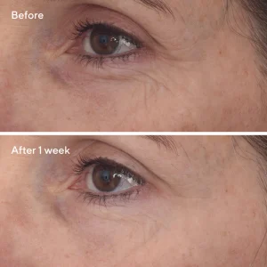 Retinal resculpt eye lift treatment / tratamiento reafirmante para el contorno de ojos