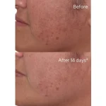 Rapid dark spot correcting serum / suero facial concentrado 30ml