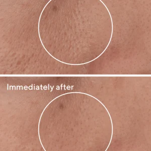 Targeted Pore Corrector