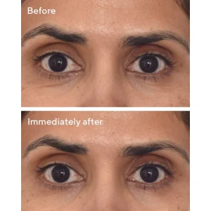 Retinol Youth Renewal Eye Masks