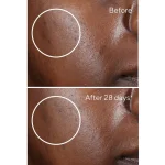 Rapid dark spot correcting serum / suero facial concentrado 30ml