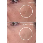 Rapid dark spot correcting serum / suero facial concentrado 30ml