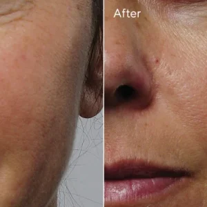 Rapid collagen infusion / tratamiento facial de murad 1.0 fl. oz.