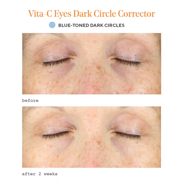 Vita-c eyes dark circle corrector / tratamiento reafirmante para el contorno de ojos 15ml