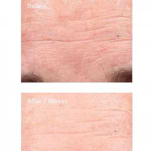 Retinol Youth Renewal Night Cream