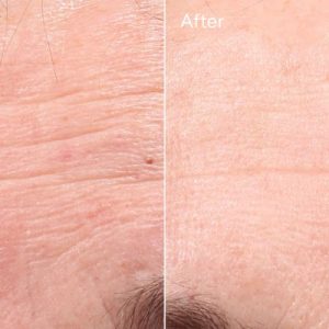 Retinol youth renewal serum / suero reafirmante con retinol 1.0 fl. oz.