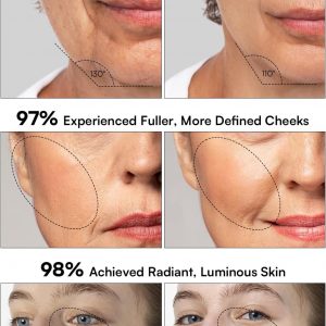 INIA 3-in-1 Skin Tightening Device True Beauty Glow Facial Massager Red Light Therapy for Face and Neck