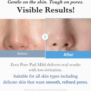 Medicube Zero Pore Pads Mild 2.0 (70 units) - Gentle Calming Toner Pads for Exfoliation, Minimizing Pores, and Blackhead Removal with PHA - Ideal for All Skin Types - Korean Skin Care