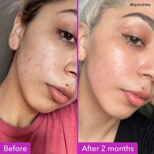 Good Molecules Niacinamide Brightening Toner