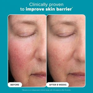 Paula's Choice 6% Mandelic Acid + 2% Lactic Acid Liquid Exfoliant