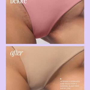 Truly Luxury After Shave Oil | Soothing & Hydrating Treatment to Prevent Ingrown Hair For Smooth, Irritation-Free Skin for Daily Use